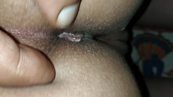 anal pain 15